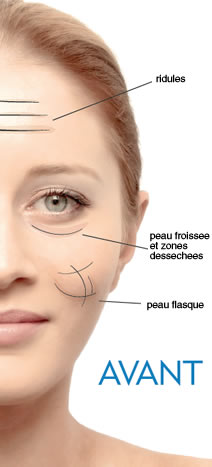 Infusion® Rejuvenate Intraceuticals Infusion® Rejuvenate Intraceuticals